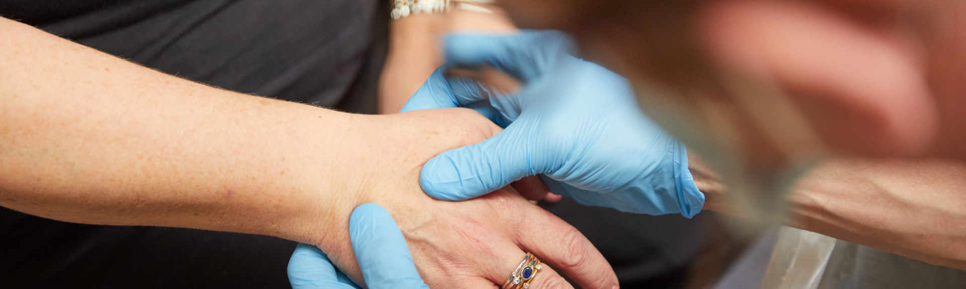 A photo showing a clinician reviewing a patients hand